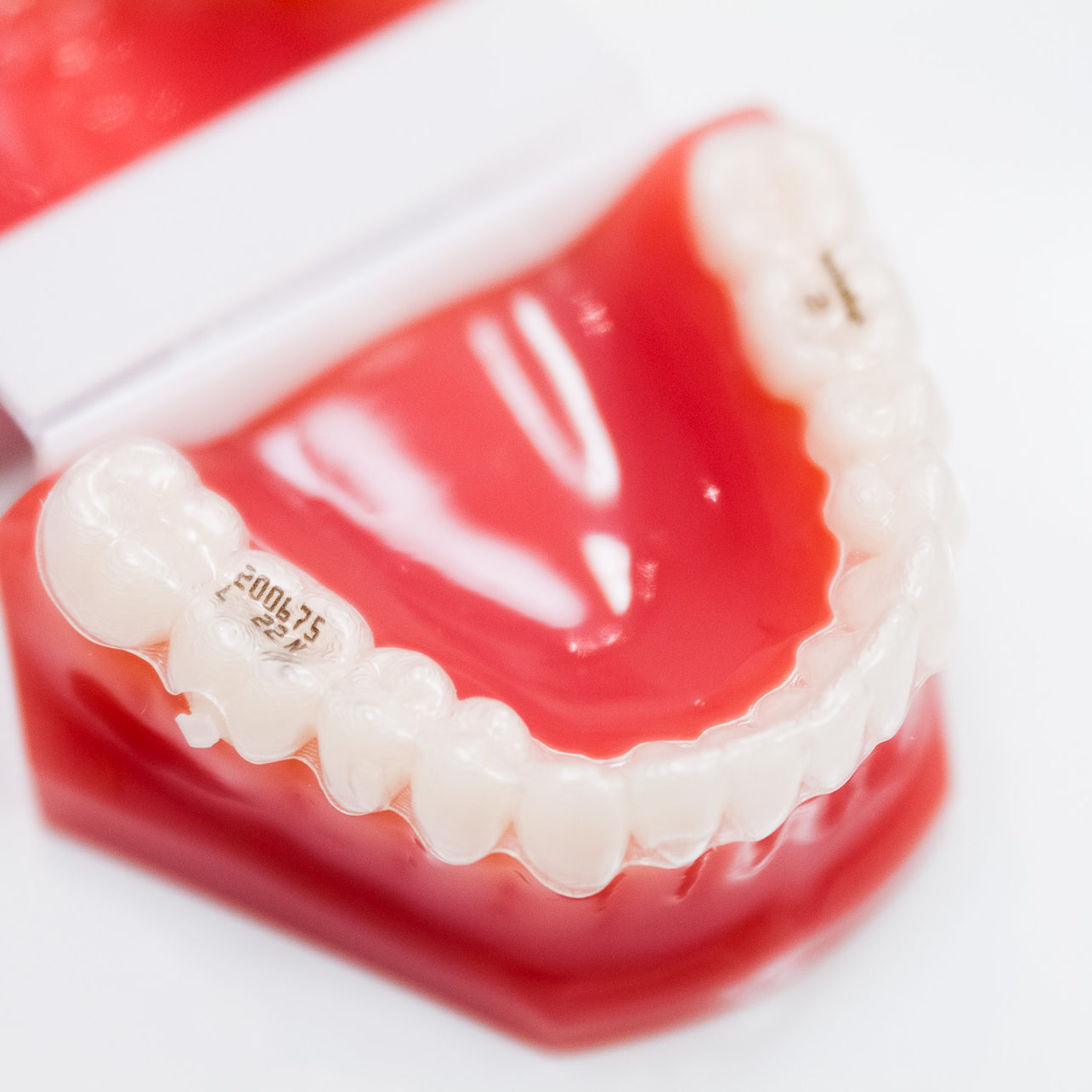 système invisalign cabinet orthodontique naegelen Kingersheim