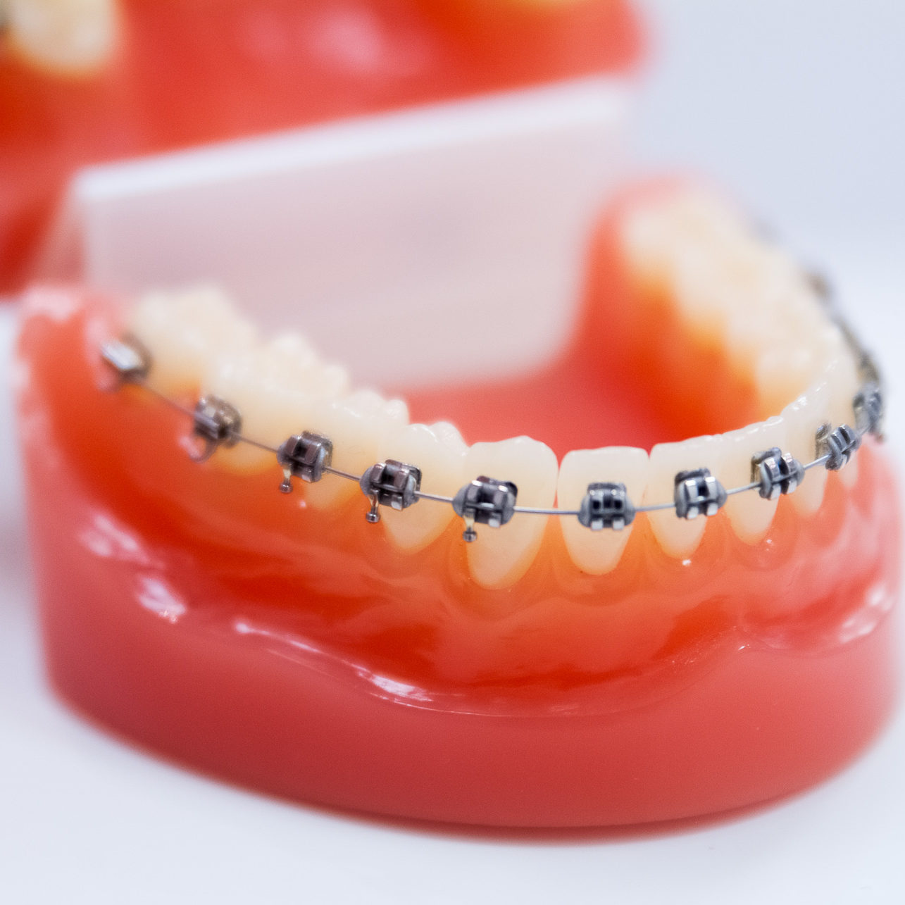 Appareil dentaire métallique mâchoire inférieur cabinet Naegelen Kingersheim