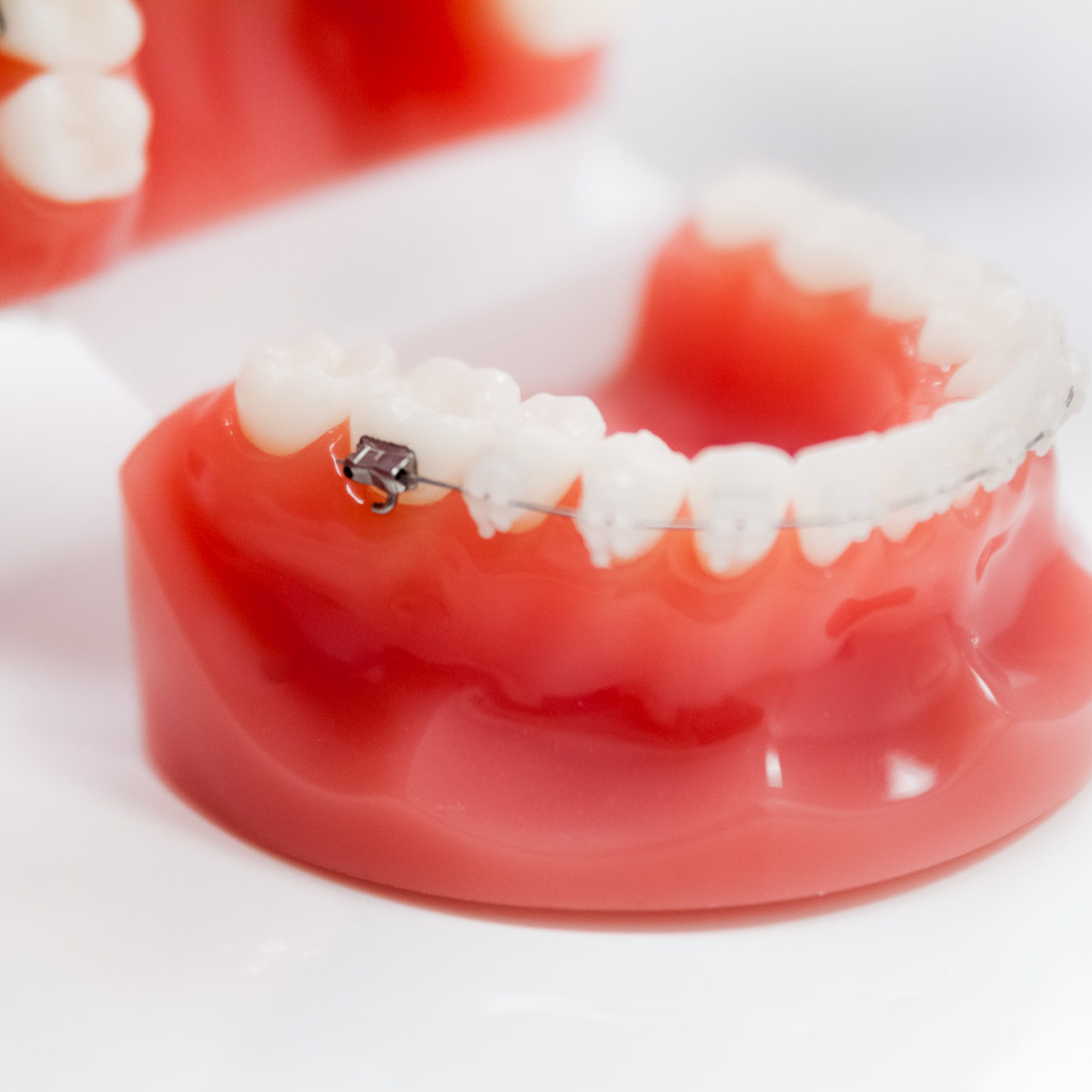 Bague transparente mâchoire inférieur, cabinet Naegelen